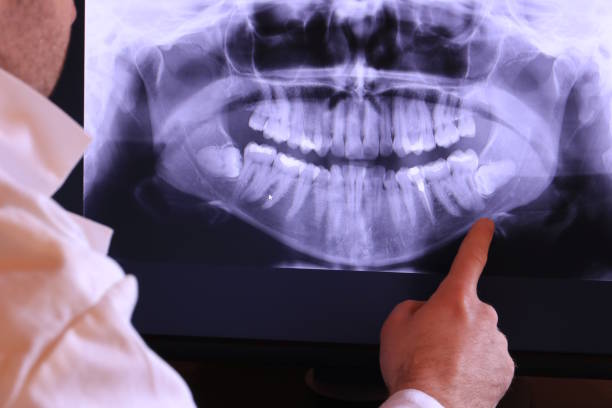 Best Emergency Dental Care for Broken or Chipped Teeth in Atkinson, NE