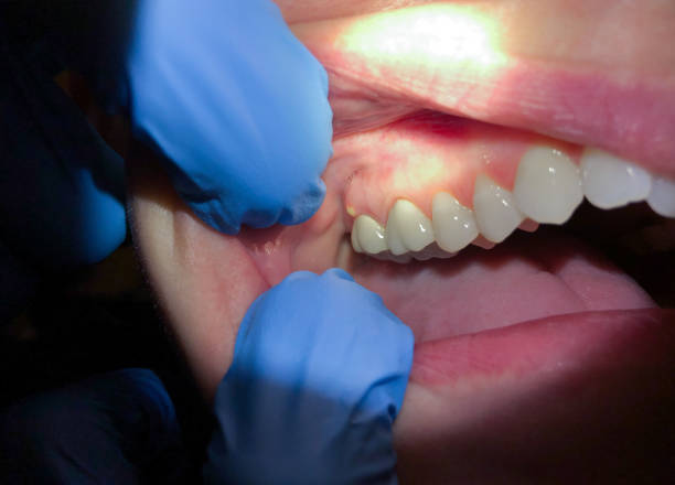 Best Urgent Care for Lost Fillings or Crowns in Atkinson, NE